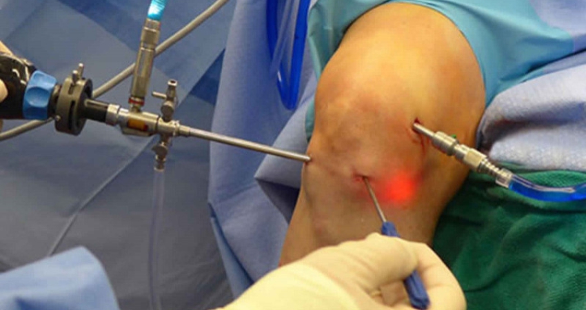 Arthroscopic Knee Surgery in Faridabad, Delhi NCR by Dr Rakesh Kumar