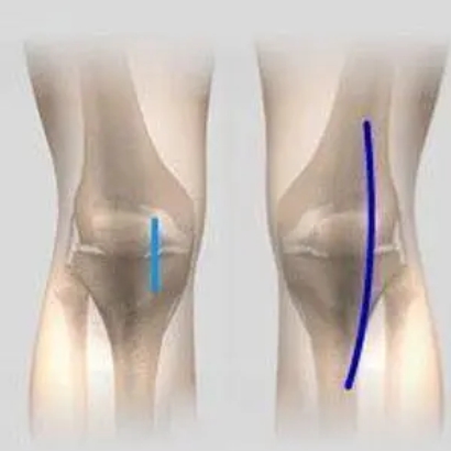 Knee pain and sports injury evaluation