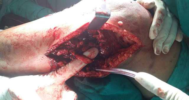 ligament injury specialist doctor