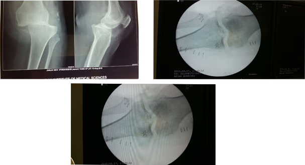 multiligament injury specialist doctor