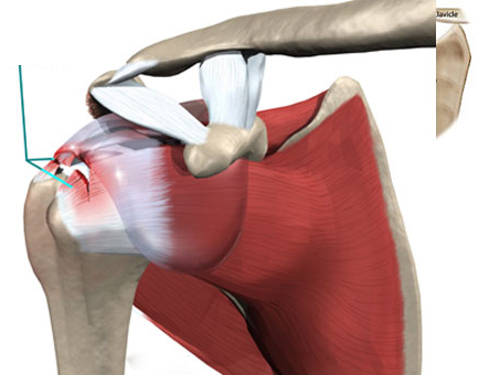 rotator cuff treatment in faridabad