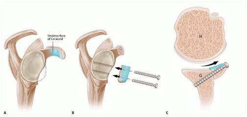 Shoulder dislocation specialist doctor.