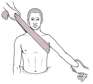 shoulder dislocation