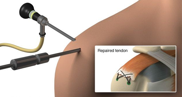 shoulder pain doctor near me