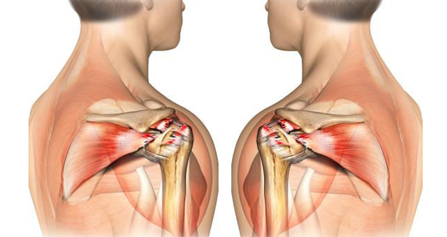 shoulder surgeon in India